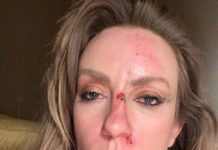 Country-Star Clare Dunn brutal von Mietwagen-Fahrer verprügelt